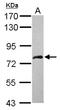 DEAD-Box Helicase 59 antibody, NBP2-16142, Novus Biologicals, Western Blot image 