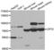 CPT1 antibody, abx002112, Abbexa, Western Blot image 