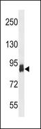 Phosphofructokinase, Platelet antibody, PA5-15432, Invitrogen Antibodies, Western Blot image 