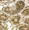UBR5 antibody, GTX89818, GeneTex, Immunohistochemistry paraffin image 