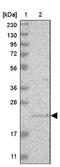 Uncharacterized protein C1orf103 antibody, NBP1-80834, Novus Biologicals, Western Blot image 
