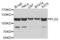 Phospholipase D2 antibody, AHP2511, Bio-Rad (formerly AbD Serotec) , Western Blot image 