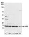 ADP Ribosylation Factor 6 antibody, A305-238A, Bethyl Labs, Western Blot image 