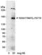 Fanconi anemia group I protein antibody, NB300-244, Novus Biologicals, Western Blot image 