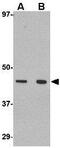 Protein Wnt-10a antibody, GTX31345, GeneTex, Western Blot image 