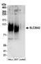 Sulfate transporter antibody, A304-466A, Bethyl Labs, Western Blot image 
