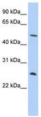 Chymotrypsin Like antibody, TA334671, Origene, Western Blot image 