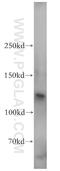 WW Domain Containing E3 Ubiquitin Protein Ligase 2 antibody, 12197-1-AP, Proteintech Group, Western Blot image 