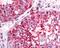 Ubiquitin C-Terminal Hydrolase L3 antibody, 48-360, ProSci, Immunohistochemistry paraffin image 
