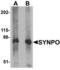 Synaptopodin antibody, LS-B5353, Lifespan Biosciences, Western Blot image 
