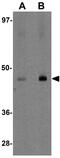 Major Facilitator Superfamily Domain Containing 2B antibody, GTX85146, GeneTex, Western Blot image 