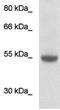 Desmin antibody, TA354682, Origene, Western Blot image 