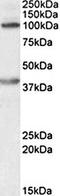 Zinc Finger E-Box Binding Homeobox 2 antibody, orb22539, Biorbyt, Western Blot image 