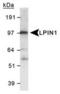 Phosphatidate phosphatase LPIN1 antibody, TA301605, Origene, Western Blot image 