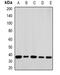 Ribosomal Protein Lateral Stalk Subunit P0 antibody, orb382014, Biorbyt, Western Blot image 