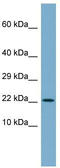 Chromosome 4 Open Reading Frame 3 antibody, TA335282, Origene, Western Blot image 