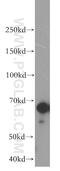2'-5'-Oligoadenylate Synthetase 2 antibody, 19279-1-AP, Proteintech Group, Western Blot image 