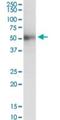 Immunoglobulin Superfamily Containing Leucine Rich Repeat antibody, H00003671-B01P, Novus Biologicals, Western Blot image 