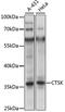 Cathepsin K antibody, A5871, ABclonal Technology, Western Blot image 
