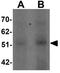 Solute Carrier Family 39 Member 14 antibody, GTX31996, GeneTex, Western Blot image 