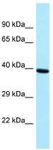 Pre-MRNA Processing Factor 18 antibody, TA343257, Origene, Western Blot image 