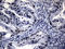 Histone-lysine N-methyltransferase NSD3 antibody, TA810021, Origene, Immunohistochemistry paraffin image 
