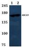ATP Binding Cassette Subfamily A Member 9 antibody, LS-C412165, Lifespan Biosciences, Western Blot image 