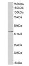 Oxidized Low Density Lipoprotein Receptor 1 antibody, orb308870, Biorbyt, Western Blot image 