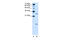 Vacuolar ATPase Assembly Factor VMA21 antibody, 31-351, ProSci, Western Blot image 