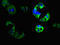 Cyclic Nucleotide Gated Channel Alpha 1 antibody, orb517656, Biorbyt, Immunofluorescence image 