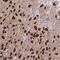 Peroxisomal Membrane Protein 4 antibody, NBP2-14703, Novus Biologicals, Immunohistochemistry frozen image 