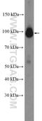 Proteasome 26S Subunit, Non-ATPase 2 antibody, 14748-1-AP, Proteintech Group, Western Blot image 