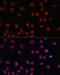 CDKN2A antibody, GTX03119, GeneTex, Immunofluorescence image 