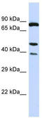 Integrin-linked protein kinase antibody, TA329148, Origene, Western Blot image 