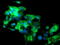 Src Like Adaptor 2 antibody, M06566-1, Boster Biological Technology, Immunofluorescence image 