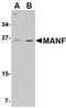 Heparin Binding EGF Like Growth Factor antibody, orb6014, Biorbyt, Western Blot image 