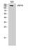 Ubiquitin carboxyl-terminal hydrolase 19 antibody, A05870-1, Boster Biological Technology, Western Blot image 