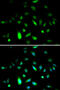 Cyclin B1 antibody, 18-470, ProSci, Immunofluorescence image 
