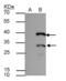 Hes-1 antibody, GTX108356, GeneTex, Immunoprecipitation image 