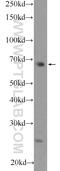 F-Box Protein 43 antibody, 55176-1-AP, Proteintech Group, Western Blot image 