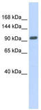 Zinc Finger Protein 512B antibody, TA331821, Origene, Western Blot image 