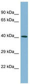 Fibronectin Type III Domain Containing 11 antibody, TA335478, Origene, Western Blot image 