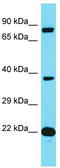 FAST Kinase Domains 3 antibody, TA331751, Origene, Western Blot image 