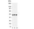C-C Motif Chemokine Receptor 4 antibody, R30590, NSJ Bioreagents, Western Blot image 
