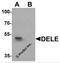 DAP3 Binding Cell Death Enhancer 1 antibody, 6919, ProSci, Western Blot image 