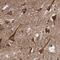 Neurobeachin antibody, PA5-59156, Invitrogen Antibodies, Immunohistochemistry frozen image 