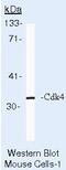 Cyclin Dependent Kinase 4 antibody, MA5-12981, Invitrogen Antibodies, Western Blot image 