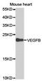 Vascular Endothelial Growth Factor B antibody, TA327289, Origene, Western Blot image 