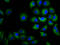 Carbohydrate Sulfotransferase 3 antibody, LS-C680280, Lifespan Biosciences, Immunofluorescence image 