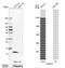 S100A10 antibody, NBP1-89370, Novus Biologicals, Western Blot image 